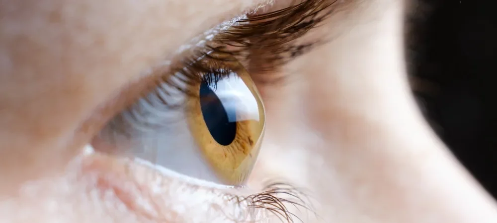 Keratokonus Nedir?