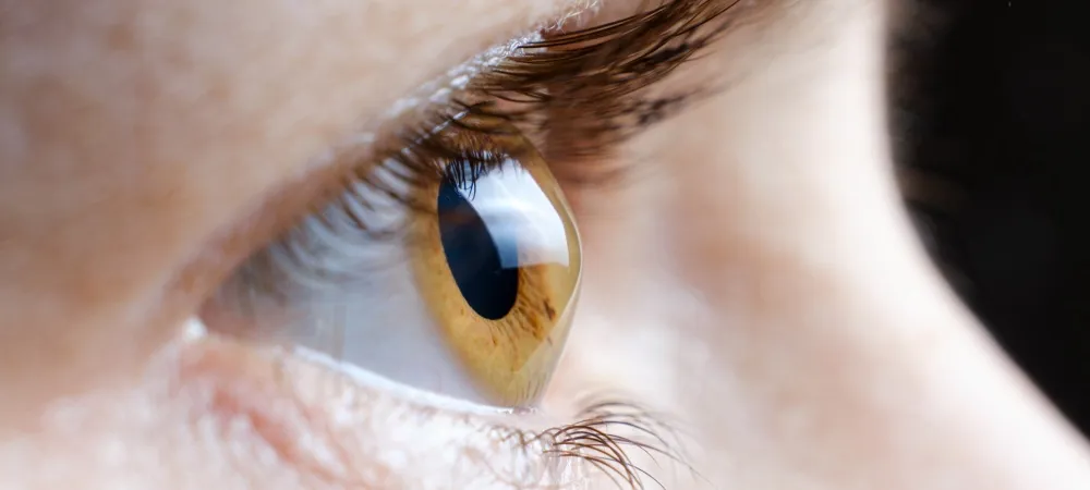 Keratokonus Nedir?